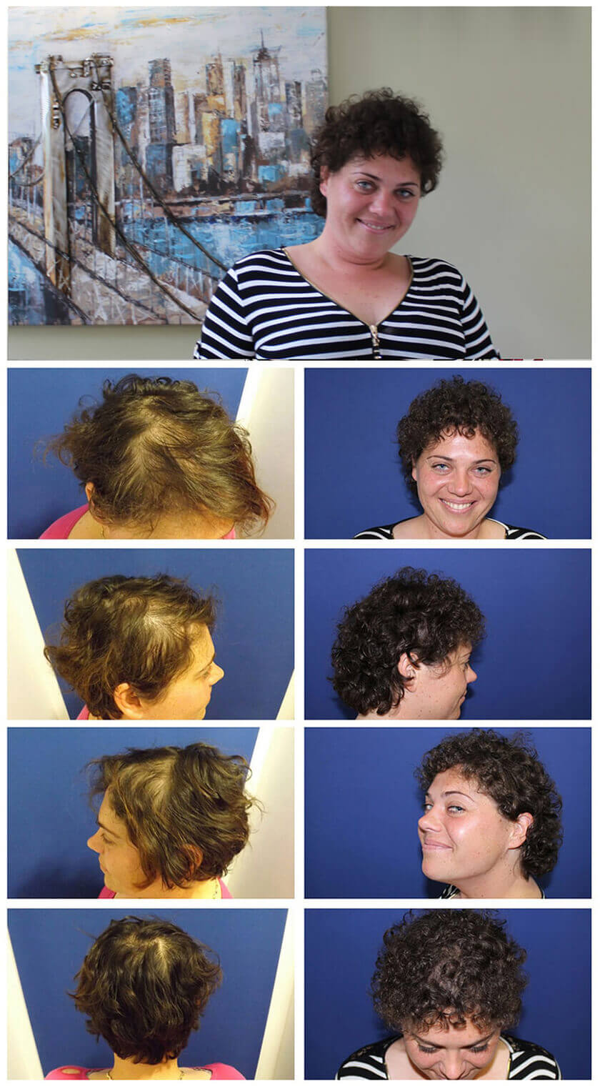 Restauration de cheveux pour femme