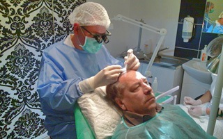 Kosa Transplant na PHAEYDE Clinic Mađarskoj
